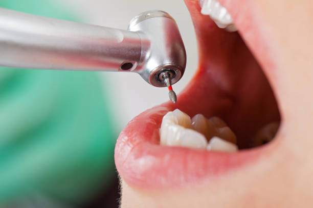 Best Emergency Dental Care for Trauma or Injury in Holyoke, MA